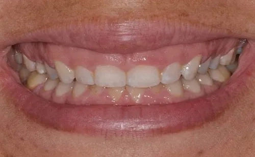 Expert periodontist at Westport Periodontics performing advanced gum grafting.